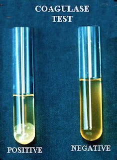 coagulase test results|Coagulase Test: Principle, Procedure, Results • Microbe Online.